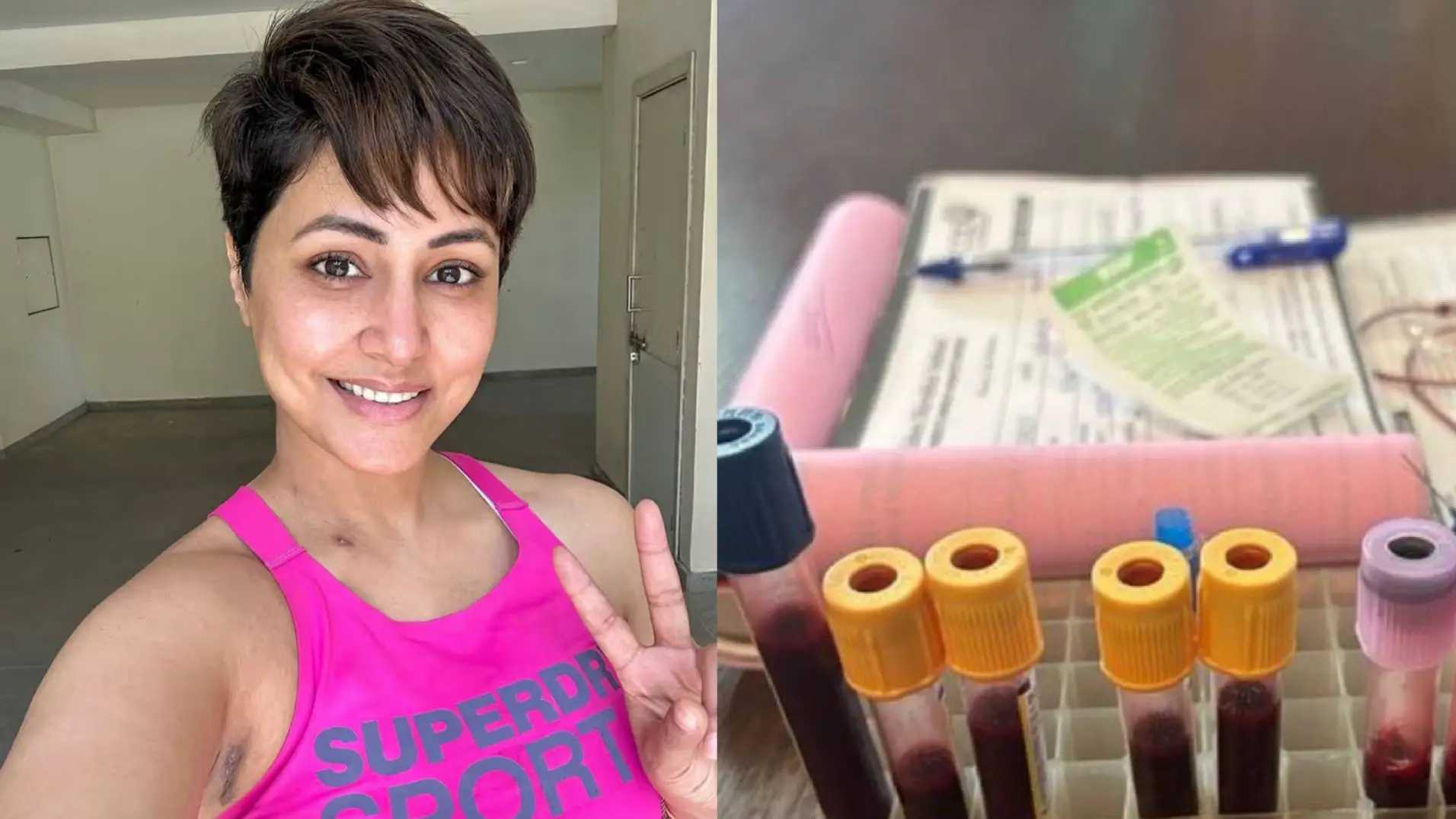 Description of the pic