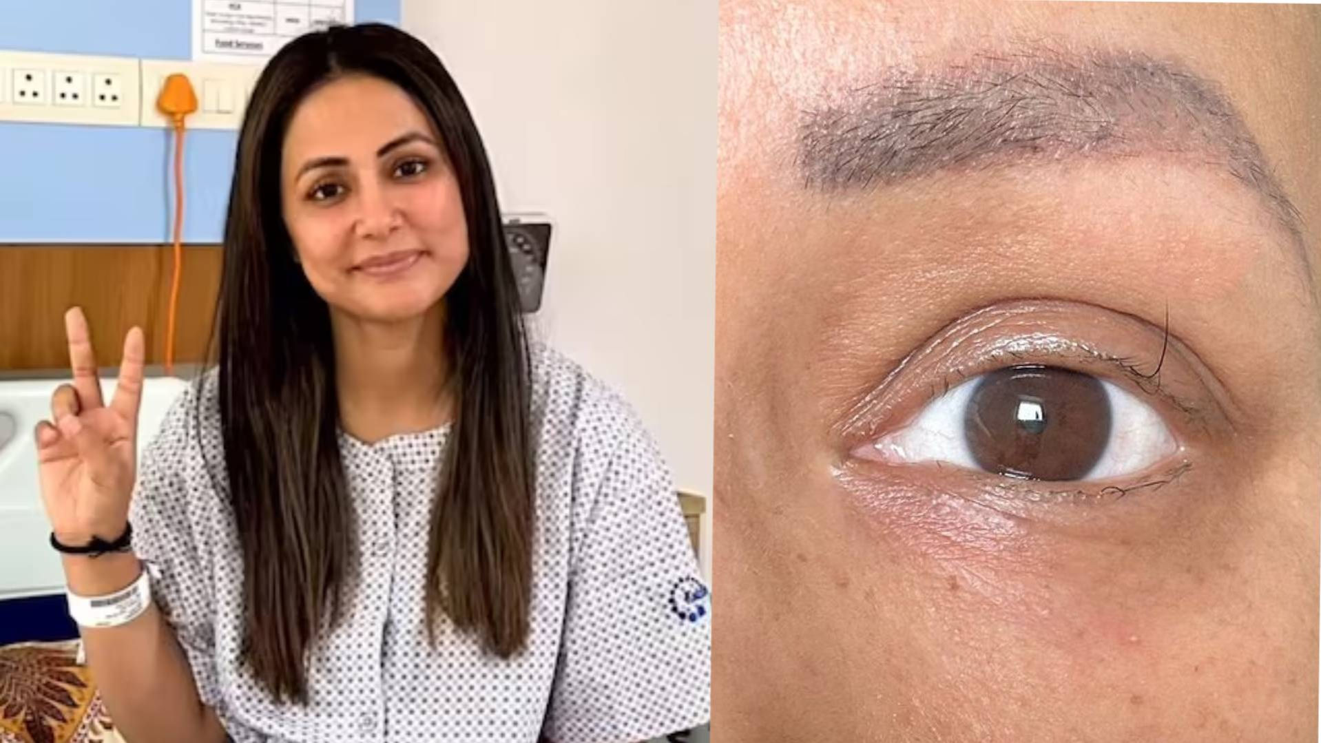 Hina Khan loses eyelashes