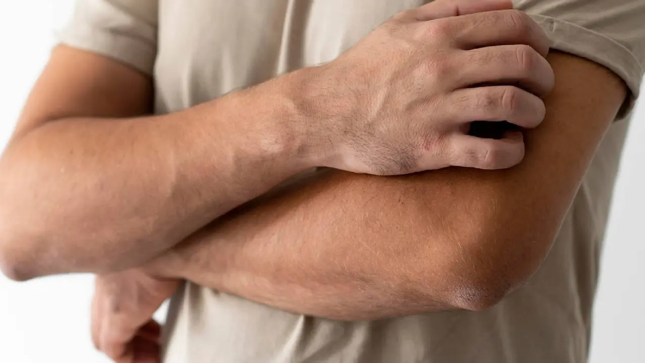How can I lighten my dark elbows fast?