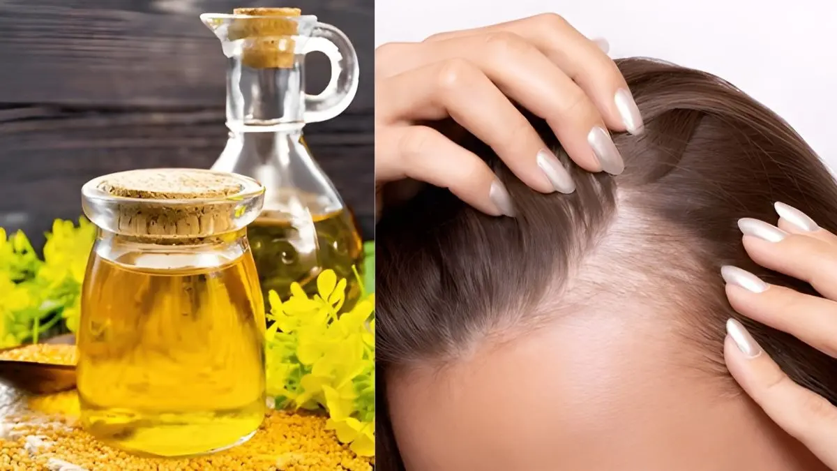 how to control baldness and grow thick hair using mustard oil on scalp sarson ke tel ko balo me lagane ke fayde