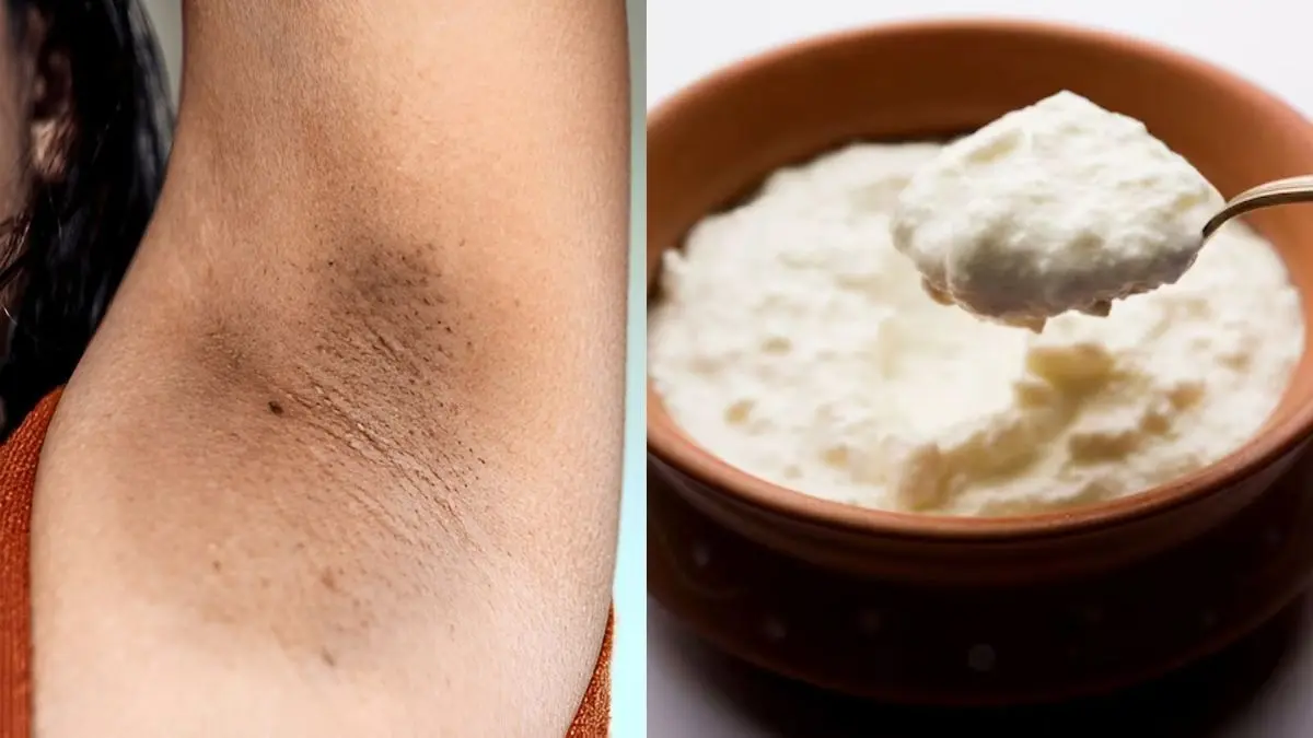 how to get rid of blackness of underarms using curd for clean and smell free skin at home