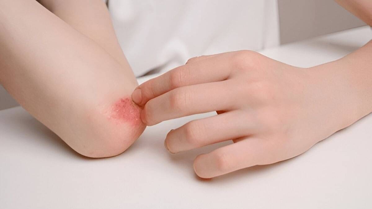 Description of the pic