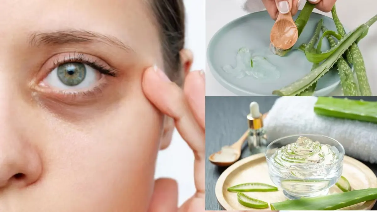 how to reduce under eye dark circles using aloe vera gel on skin aankhon ke niche kale ghere kam karne ke upay