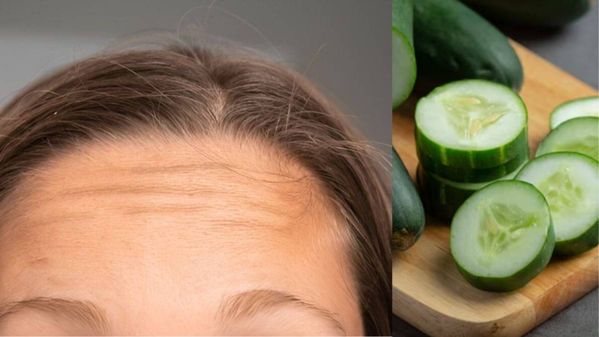 how to remove blackness of dark forehead using cucumber and gram flour tanning removal treatment using kheera and besan on face to get glowing skin