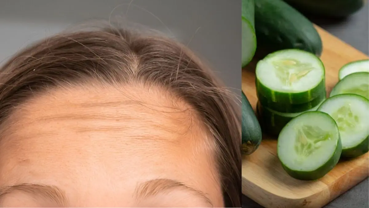 how to remove blackness of dark forehead using cucumber and gram flour tanning removal treatment using kheera and besan on face to get glowing skin