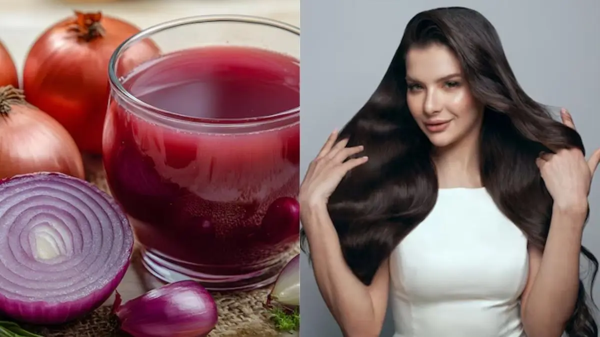 how to stop hair fall and get rid of itchy scalp using onion juice balo me pyaj ka ras lagane ke fayde