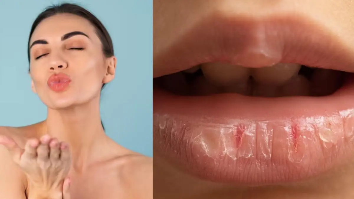 how to take care of dry lips in winter and make them soft and pink