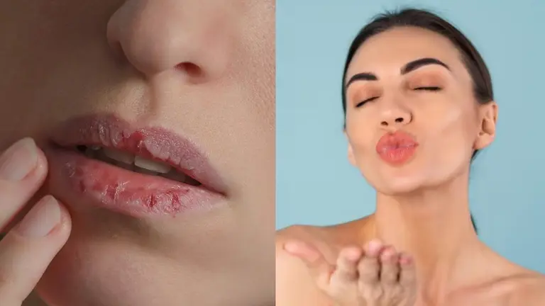 Dry Lips: कटे-फटे होंठों पर रोजाना लगाएं कच्चे दूध के साथ ये चीजें, कम होगी लिप ड्राईनेस, होंठ दिखेंगे पिंक-पिंक how to take care of dry lips using raw milk rose water and honey gulabi honthon ke upay gulab jal for pink lips