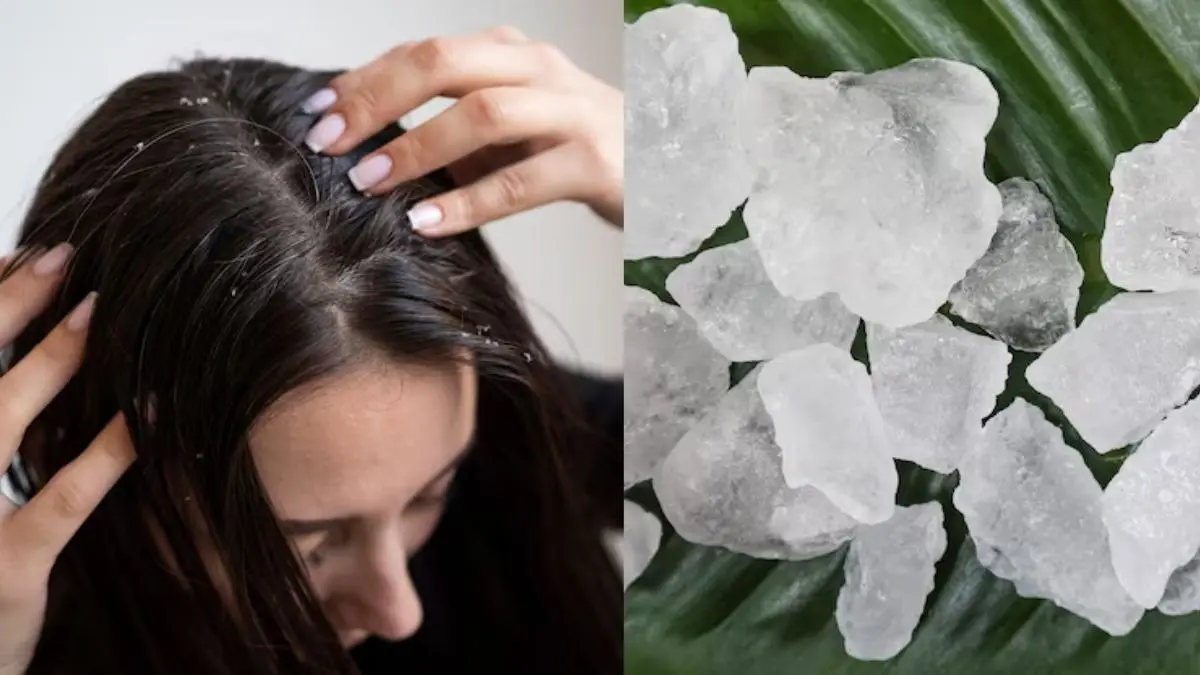 White Hair Home Remedy: कम उम्र में सफेद बालों से हैं परेशान, तो फिटकरी का ये देसी नुस्खा कर सकता है कमाल, नुकसान और सही इस्तेमाल how to use alum for White hair