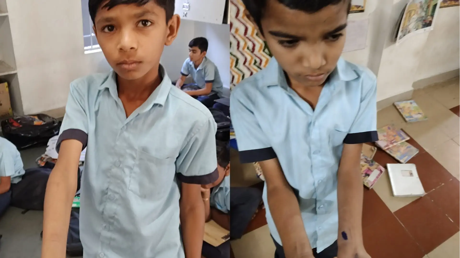 ‘Truth & Dare’ Turns Ugly: Blade Marks Found on Gujarat School Kids, Disturbing Photos Emerge