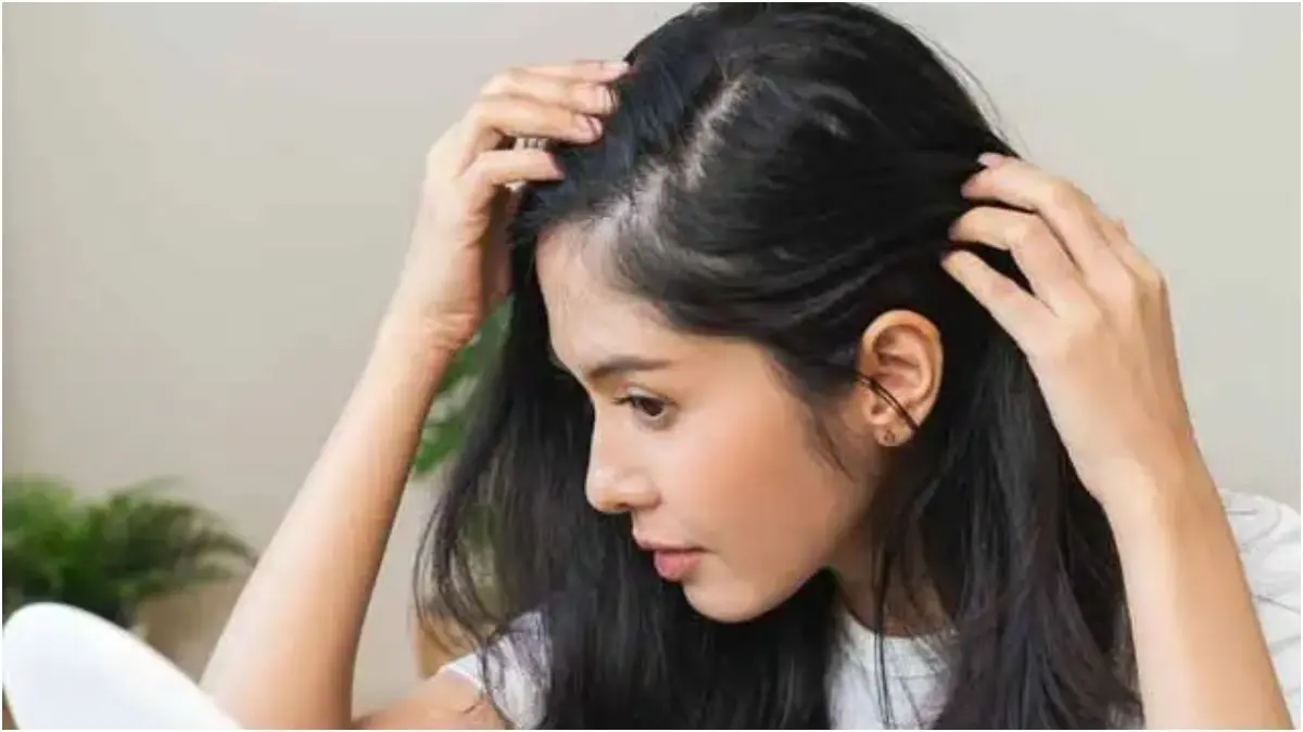 Image for representation