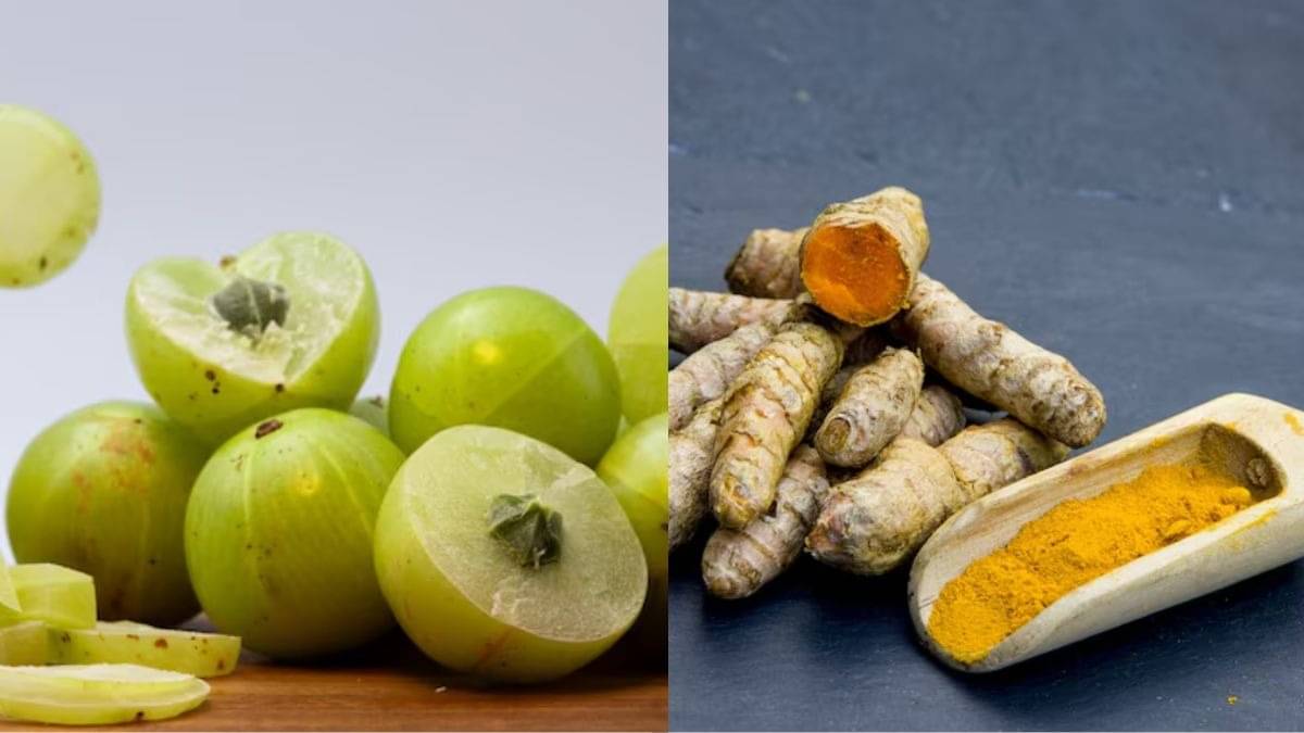 Description of the pic