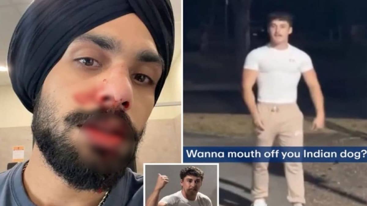 Indian-Origin Nurse Attacked: 'इंडियन डॉग, GO BACK', ऑस्ट्रेलिया में सिख युवक पर नस्लीय टिप्पणी के बाद हमला, टूटी नाक की हड्डी