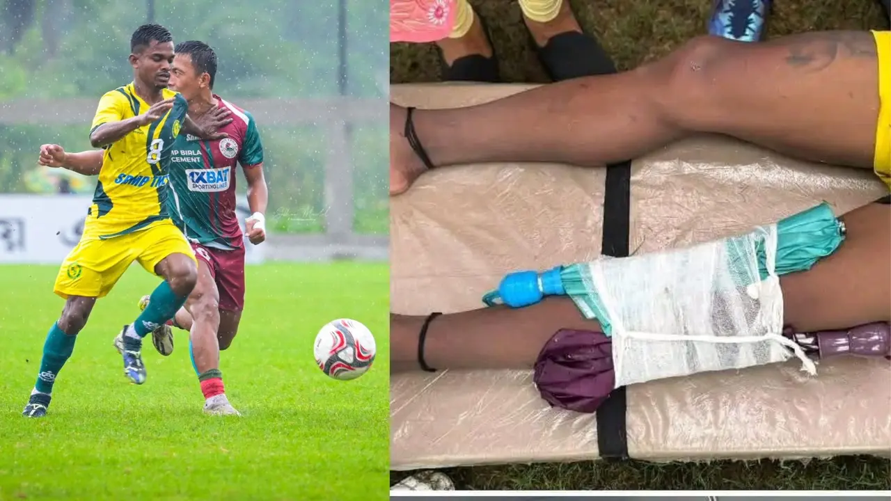 Indian footballer Tarak Hembram's fractured leg was treated using umbrellas.