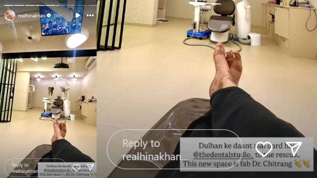 Description of the pic