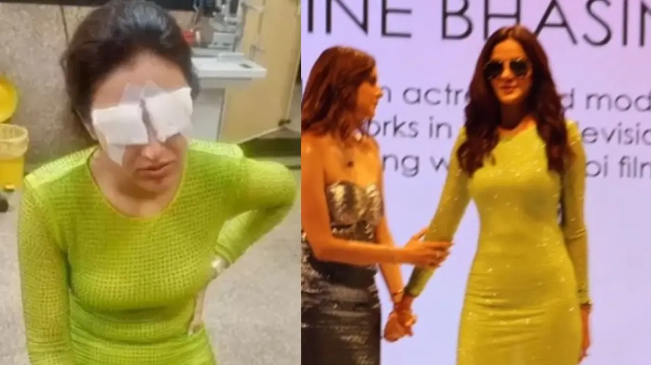 Jasmin Bhasin eye injury