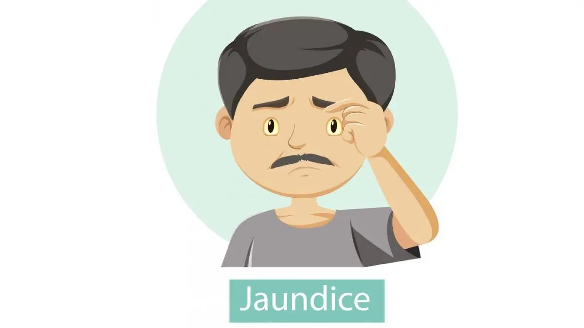 Jaundice Symptoms