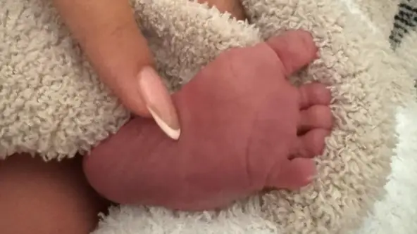 Description of the pic