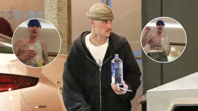 Justin Bieber has sparked health concern over his public appearances