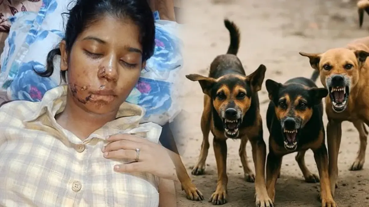 Kanpur Horror: BBA Student Brutally Attacked by Stray Dogs, 17 Stitches on Face Kanpur Horror: BBA Student Brutally Attacked by Stray Dogs, 17 Stitches on Face