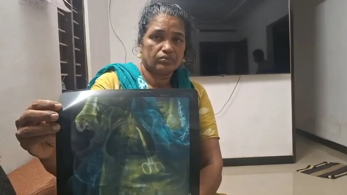 Kerala Shocker: Scissors Left In Woman's Abdomen After Surgery, Goes Undiagnosed For 5 Years Kerala Medical Negligence: Scissors Left Inside Woman's Abdomen After Surgery, Goes Undiagnosed For 5 Years