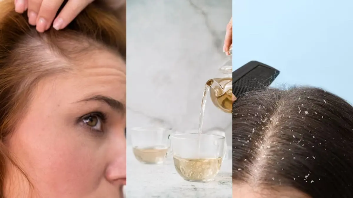 Keratin Hair Tips: झड़ते और डैंड्रफ बालों से हैं परेशान तो किचन की ये चीज आपके लिए हो सकती है चमत्कारी, बस पानी में डालकर करें ये काम Keratin Hair Tips