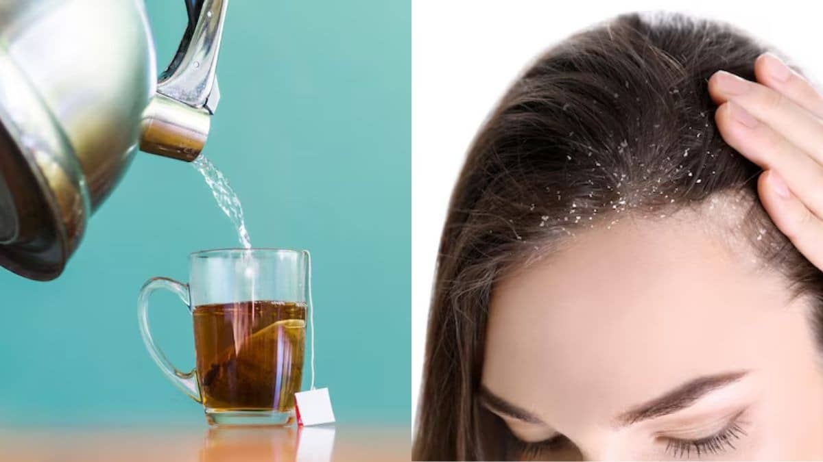 Description of the pic