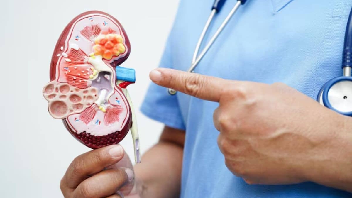 Kidney Damage