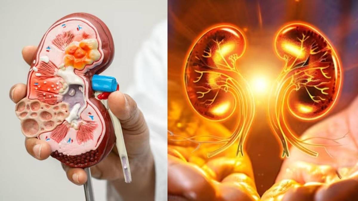 Kidney Health