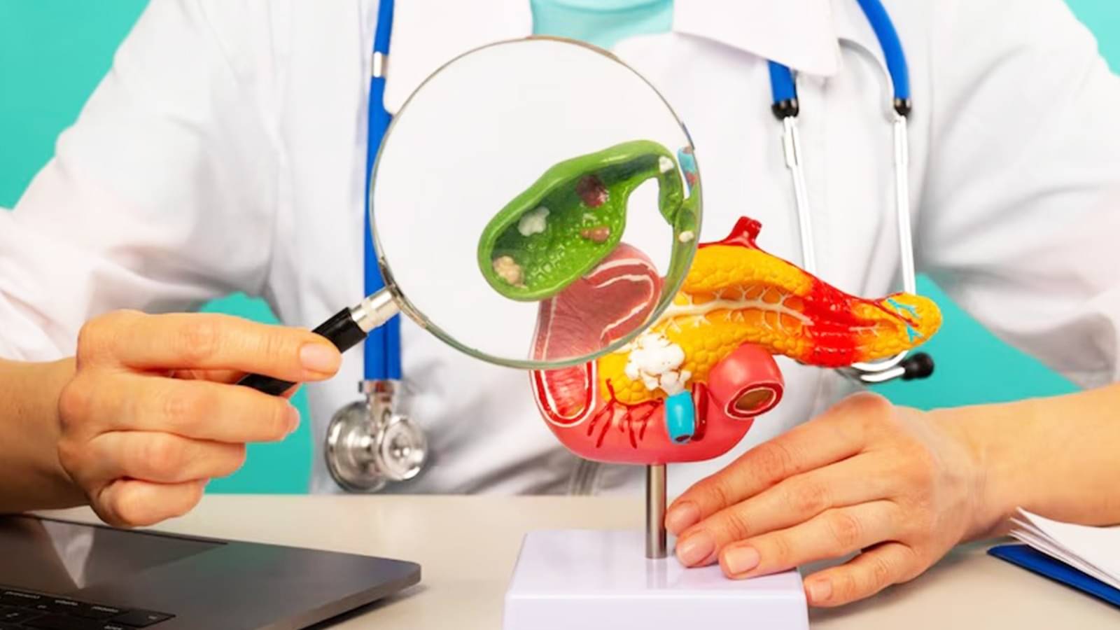 Description of the pic