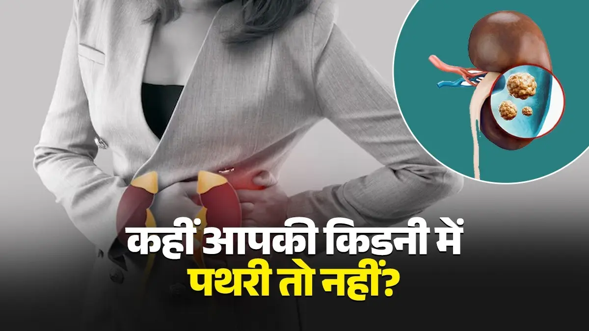 Kidney Stone Symptoms: शरीर में दिखने लगें ये 5 लक्षण तो हो जाएं सावधान, किडनी में पथरी के संकेत; डाइट से फौरन हटाएं ये चीजें kidney stone symptoms signs avoid eating these food items and know what to eat healthy diet tips