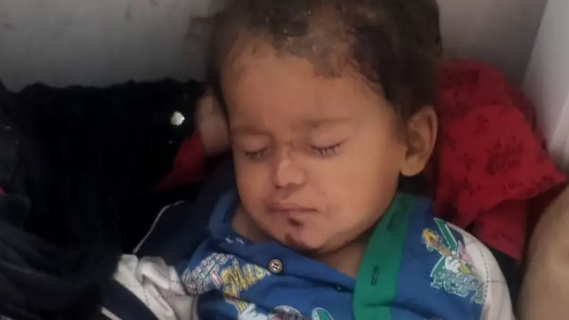 Description of the pic