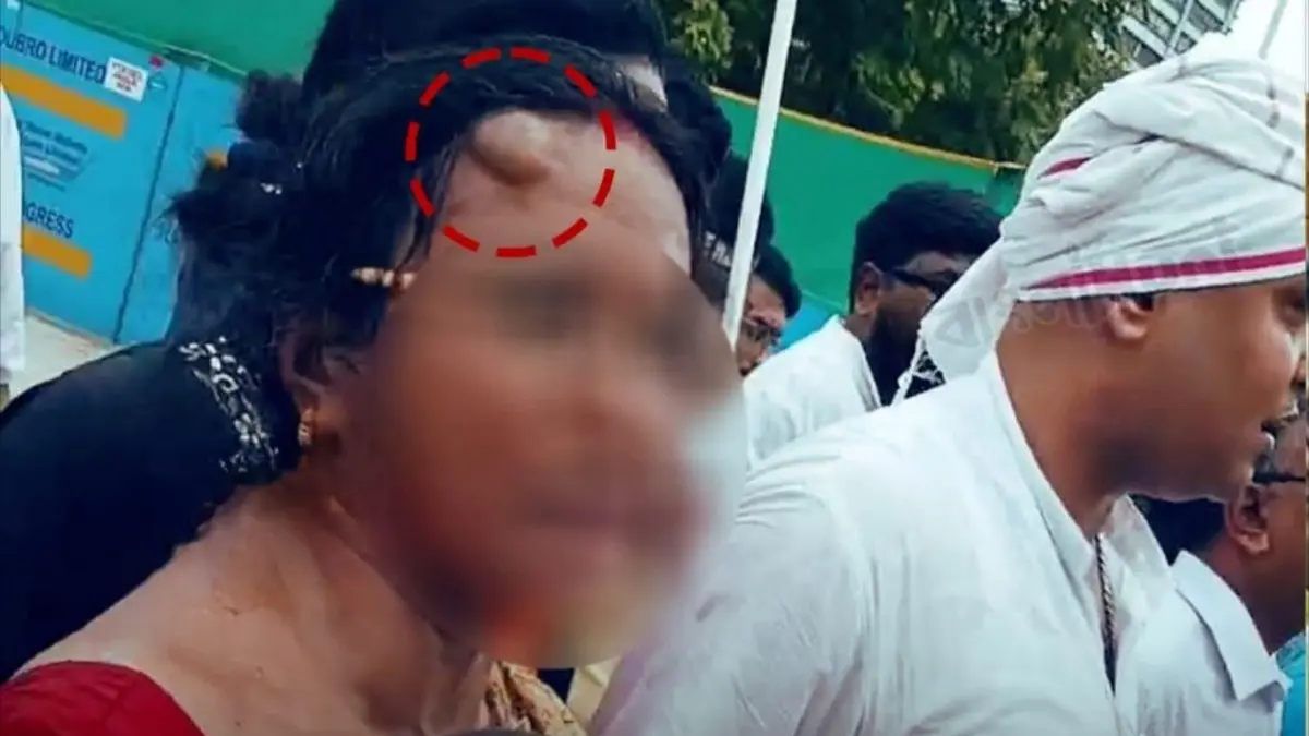 Kolkata Police 'Beat Up' RG Kar Rape Victim's Parents