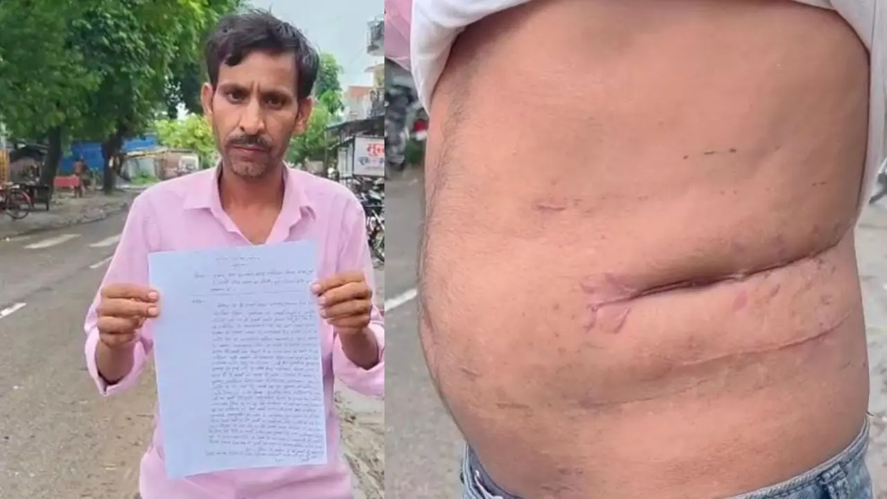 kushinagar news patient kidney removed through stone operation