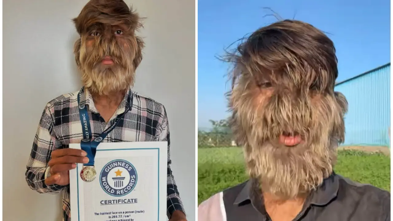 Lalit Patidar sets Guinness World Record for hairiest male face