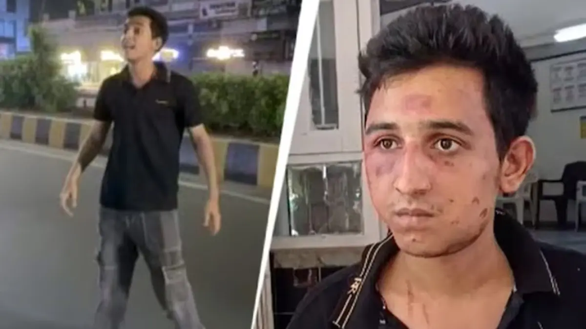 Not Alcohol, But Drugs: Vadodara Crash Accused Rakshit Chaurasia's FSL Report Makes Chilling Revelations Law Student Behind Vadodara Crash Was on Drugs