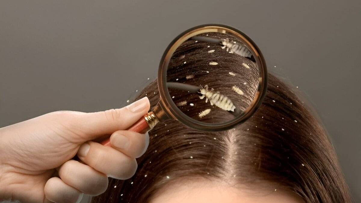 lice from hair