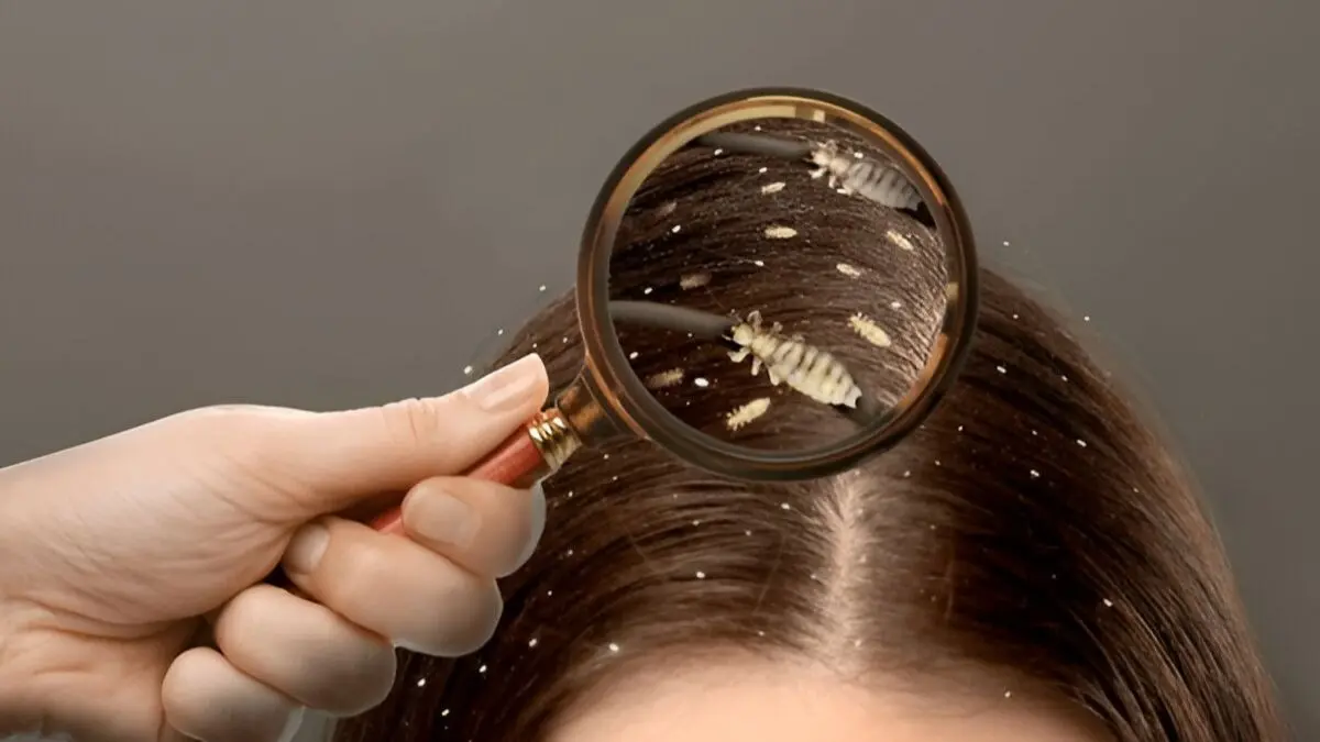 lice from hair