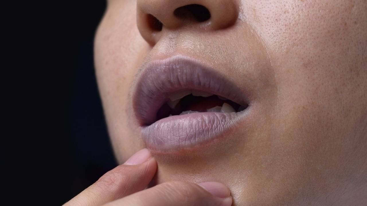 Description of the pic