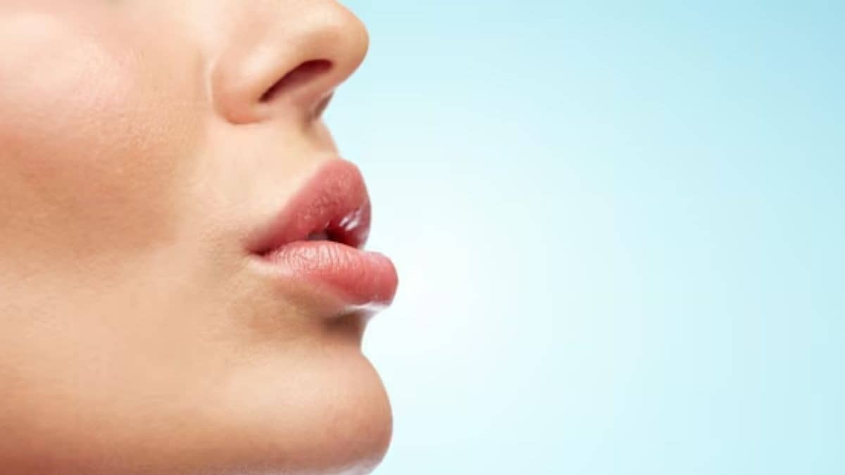 Description of the pic