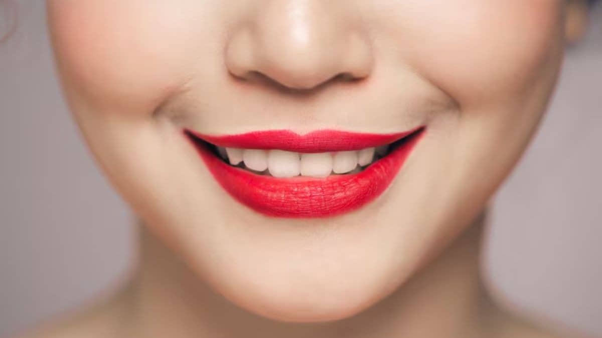 Description of the pic