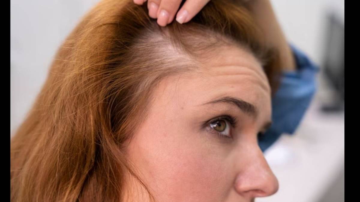 Description of the pic