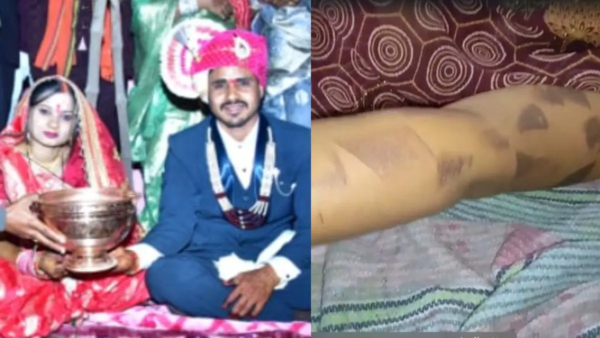 Madhya Pradesh Dowry case