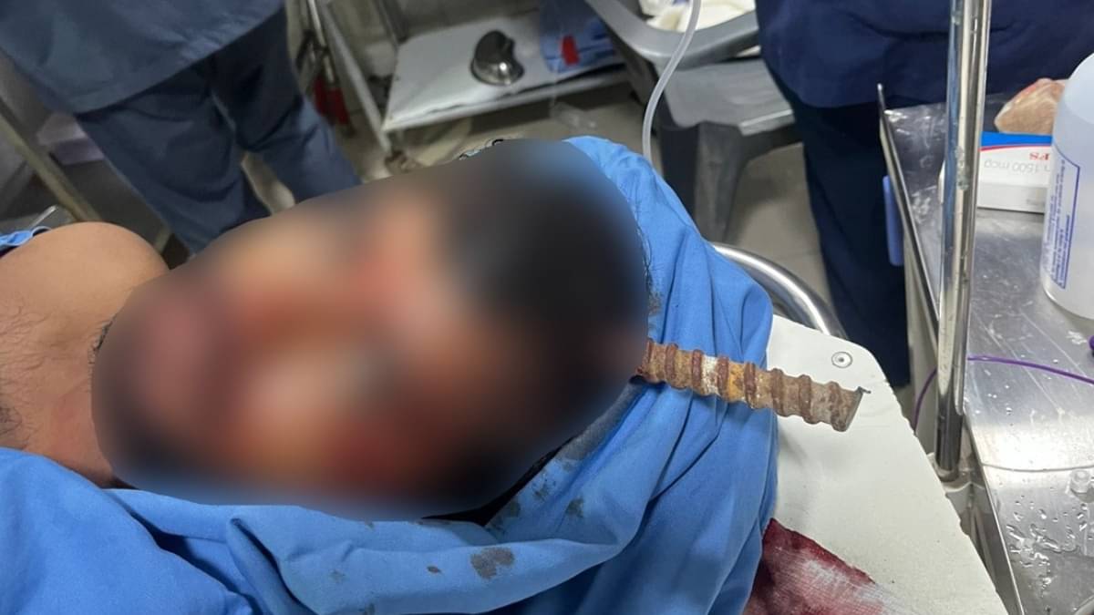 5-Foot Long Iron Rod Fell From Metro Site Piercing Man's Head, Condition Remains Critical thumbnail