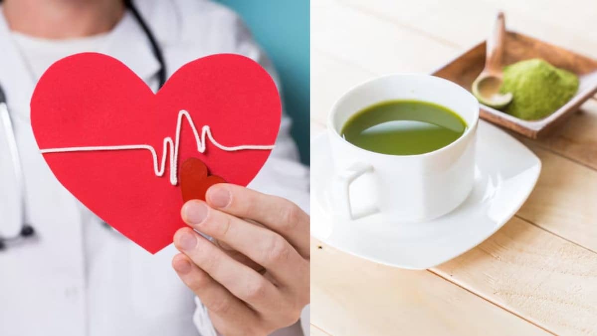 Description of the pic