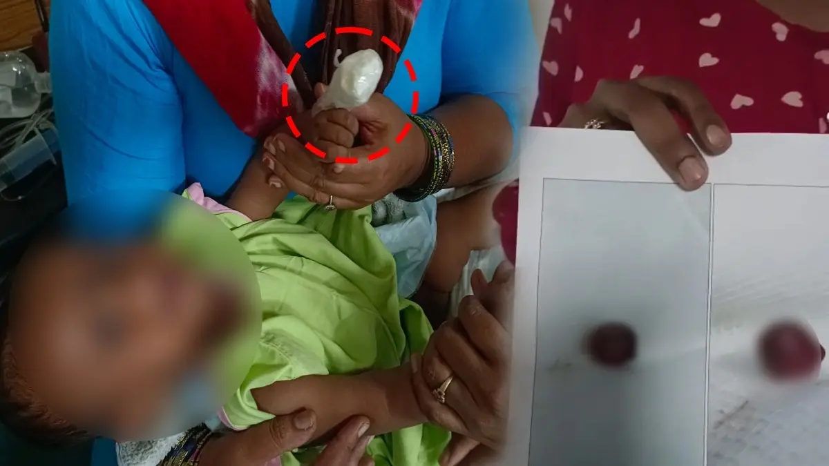 Medical Horror In Bengaluru: 6-Month-Old Infant’s Finger Partially Severed During IV Removal; FIR Filed For Medical Negligence Medical Horror In Bengaluru: 6-Months-Old Infant’s Finger Partially Severed During IV Removal; FIR Filed For Medical Negligence