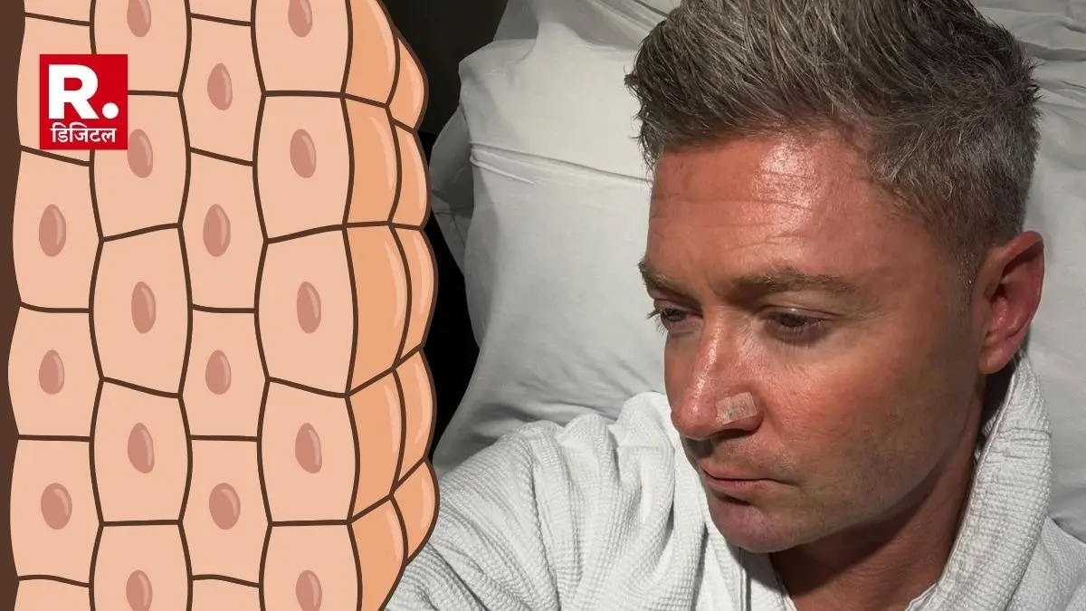 Michael Clarke underwent his sixth surgery for skin cancer these are early symptoms