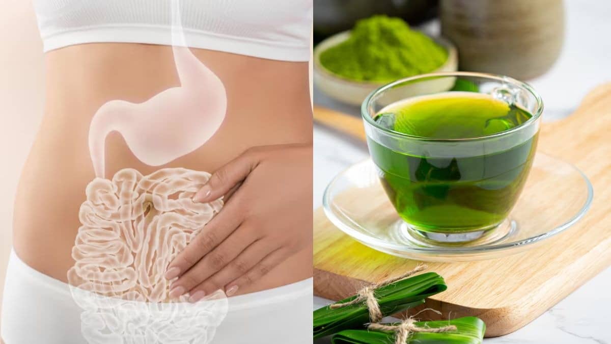 Description of the pic