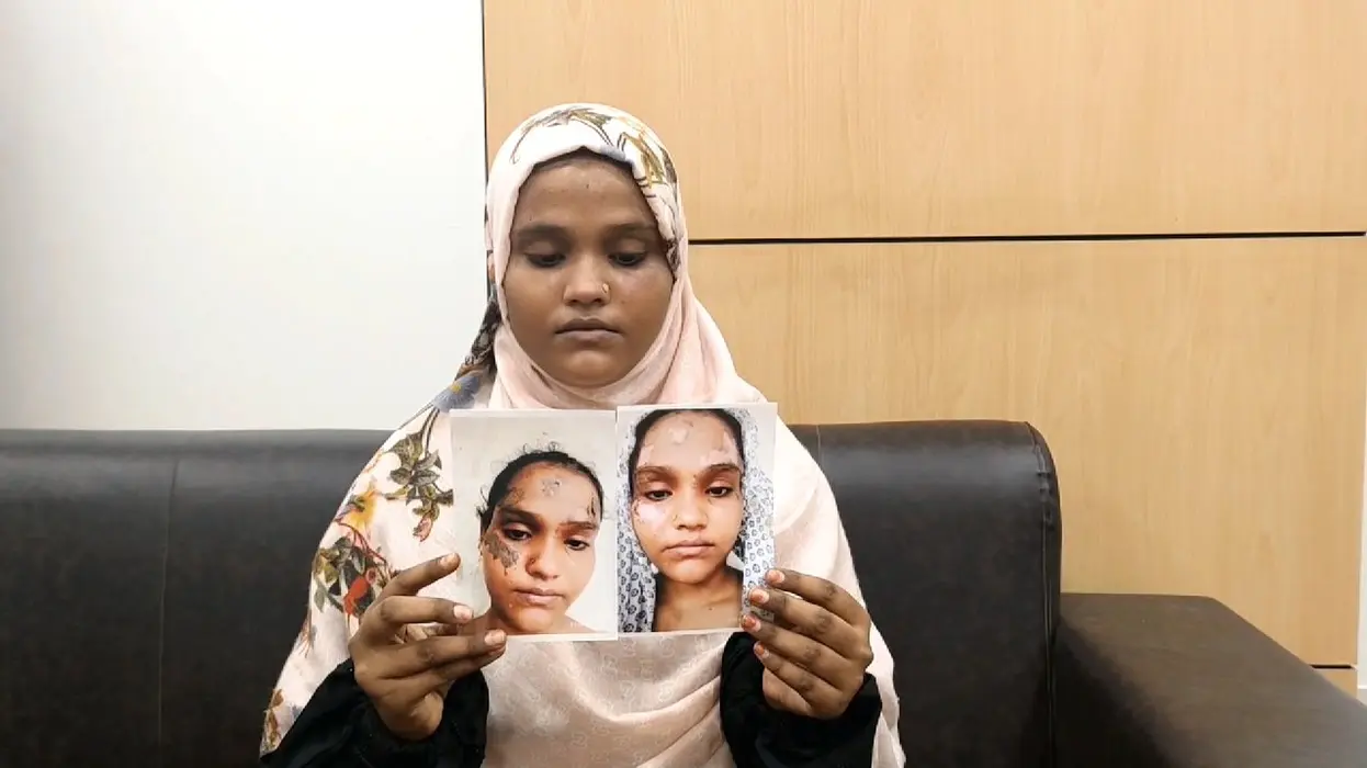 Muslim Woman Beaten, Poured Hot ‘Dal’ And Given Triple Talaq In Ayodhya For Praising CM Yogi Muslim woman beaten up and given triple talaq for praising CM Yogi