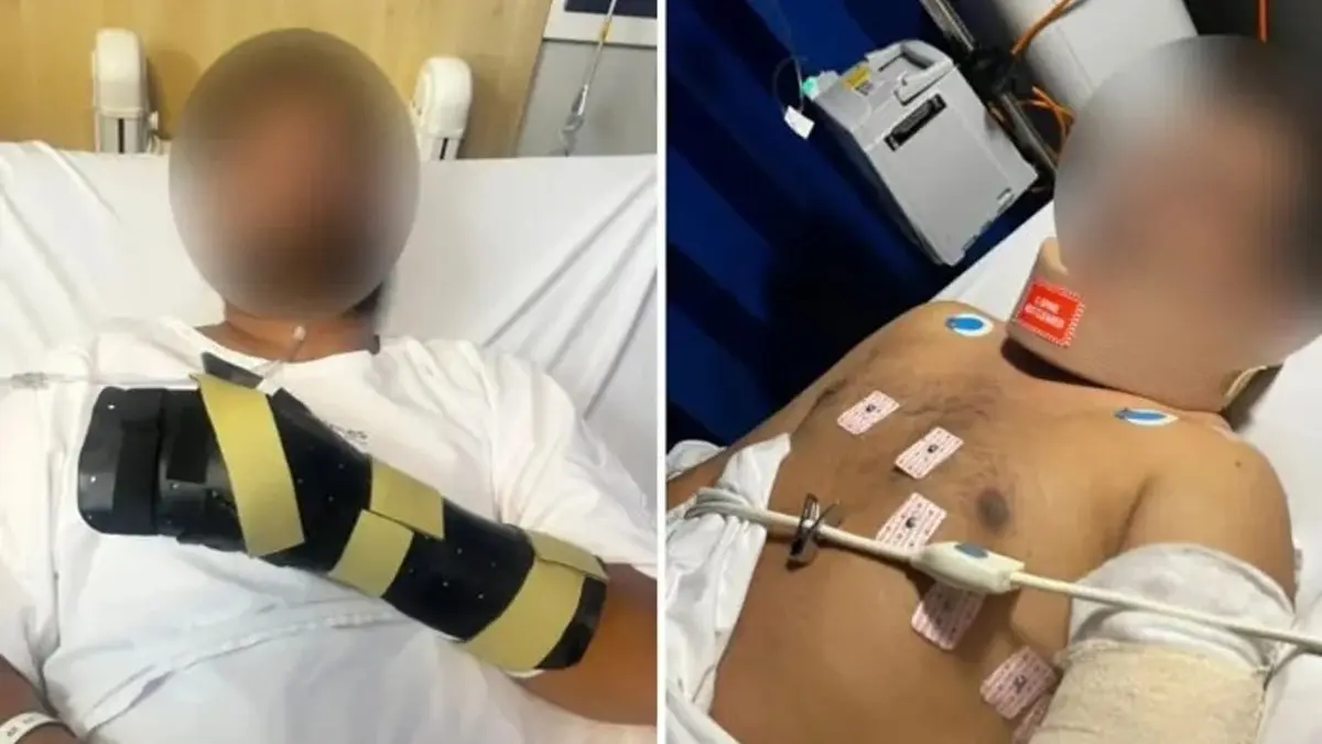 'My Hand Was Hanging by a Thread': Indian-Origin Man Brutally Attacked by Teen Gang in Melbourne 'My Hand Was Hanging by a Thread': Indian-Origin Man Brutally Attacked by Teen Gang in Melbourne